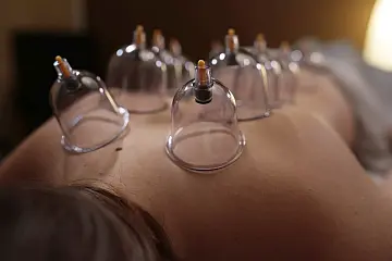 Úvodní fotka k baňkování